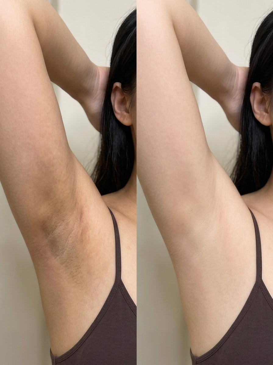 Antes e depois — Rosto